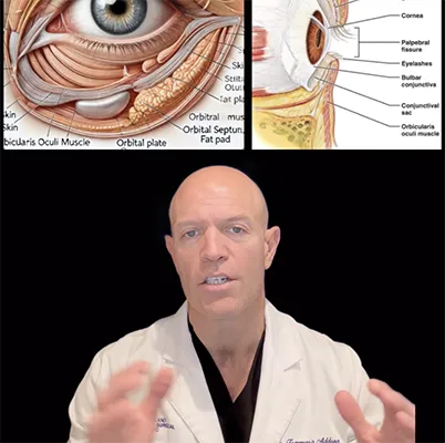 Dr. Addona Upper Blepharoplasty March 2025