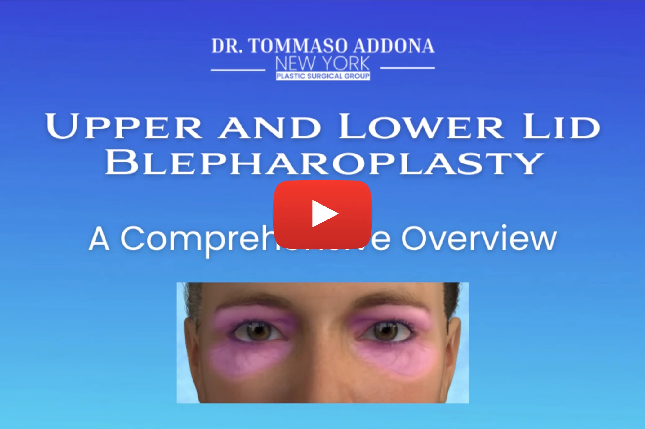 NYPSG-Mommy-Makeover-screenshot