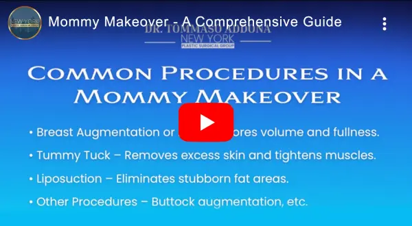 NYPSG-Mommy-Makeover-screenshot